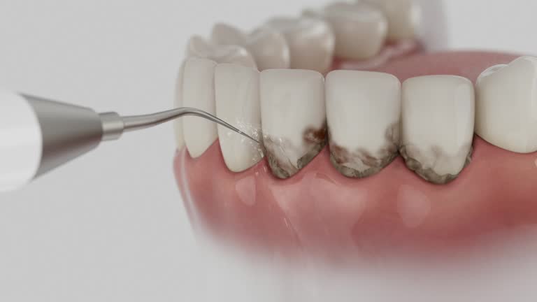 Reliable Dental Implants contractor in Ritchie County County, WV by Dentist Open Now